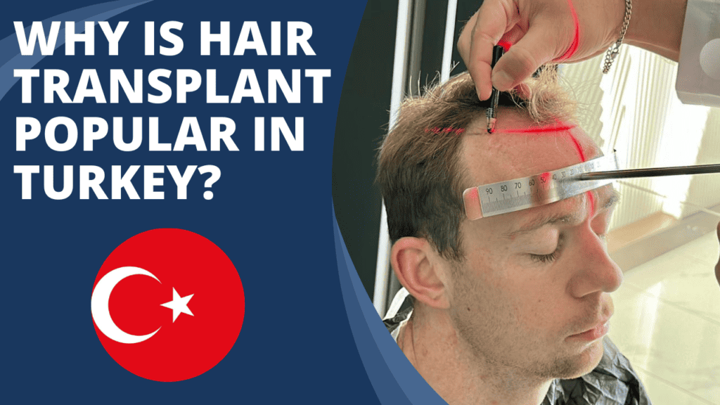 5 Reasons To Should Travel To Turkey For Hair Transplant