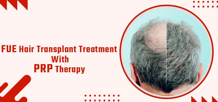 Are the PRP Included Hair Transplant Packages just a Marketing Strategy