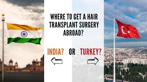 Hair Transplant Cost: Turkey vs India