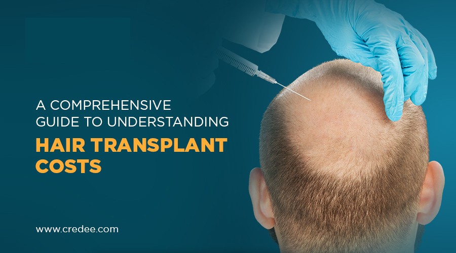 New Hair Transplant Techniques With Their Costs 2024