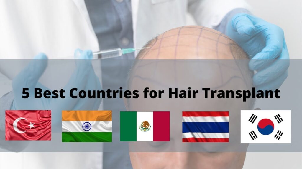 Top 5 Cheapest Countries for Hair Transplant