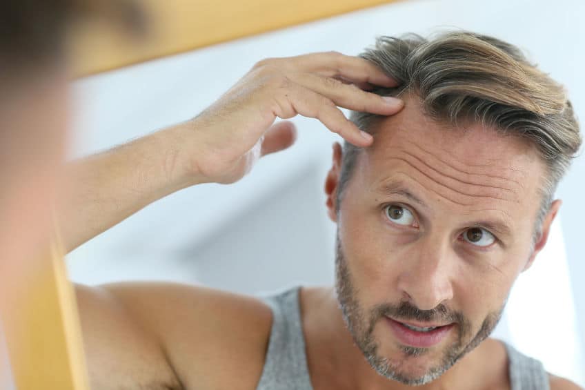 What Is the Cost of Revision Surgery for Hair Transplant?